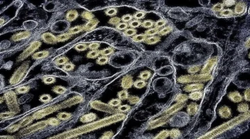 شهادة شفاء جديدة تُثري أبحاث فيروس نقص المناعة البشرية بعد زراعة خلايا جذعية ناجحة 1